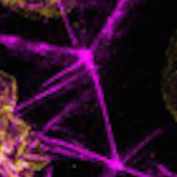 Testing the function of calcium in programmed cell death