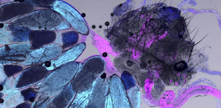 Fly ovary with posterior cuticle, Actin (magenta), P podies (cyan), Dapi (blue)