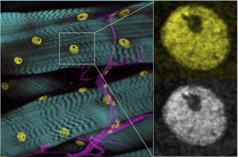 Epigenetic marks in muscle nuclei (yellow), showing nerves (magenta) and actin (cyan).