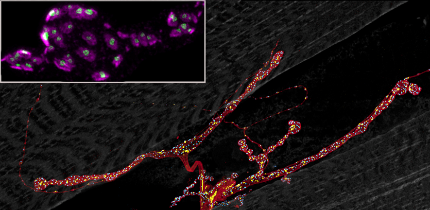 Neuromuscular junction in the Drosophila larva